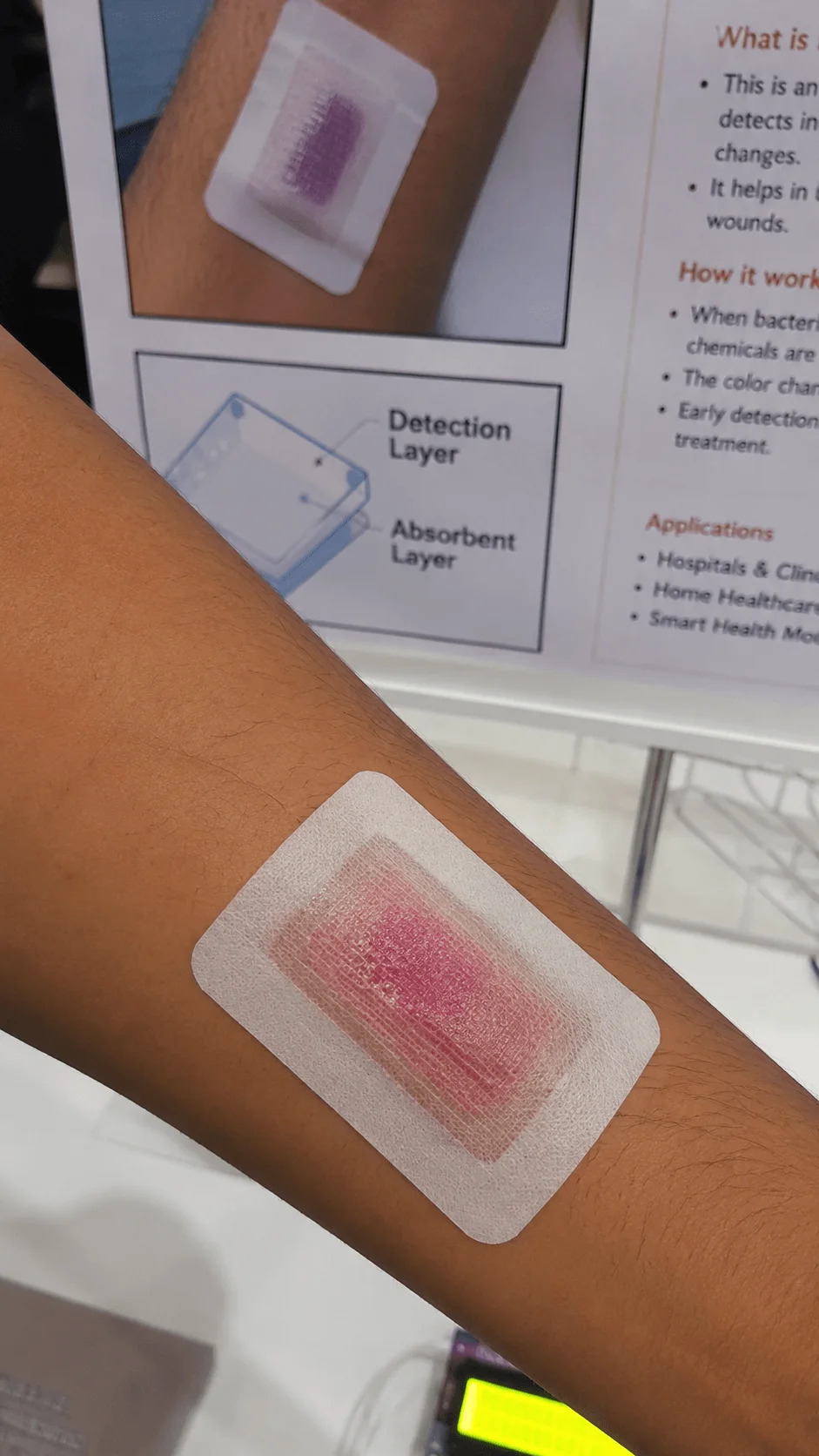 Color changing infection detection bandage project showing a smart medical bandage applied on an arm designed to detect wound infections through visible color changes with layered absorbent and detection materials displayed on an educational poster background